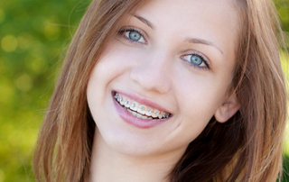 Blog – DelliGatti and Milewski Orthodontic Group